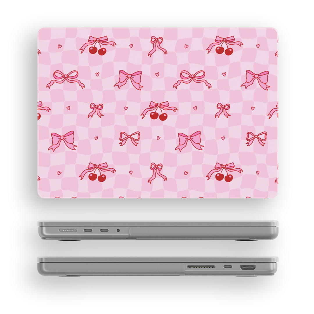 Cute pink MacBook case with red bows, cherries, and hearts on a gingham checker pattern, ideal for students, creatives, and girly office style.