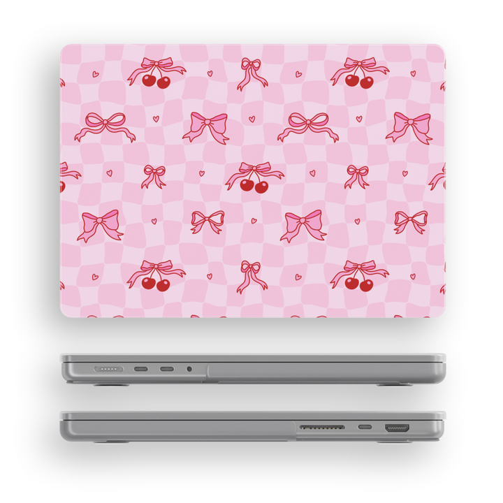Cute pink MacBook case with red bows, cherries, and hearts on a gingham checker pattern, ideal for students, creatives, and girly office style.