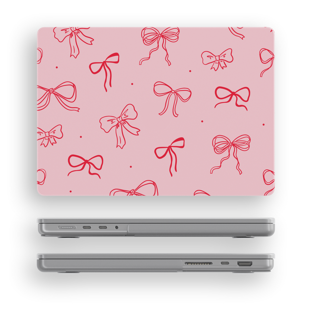Pink bow MacBook case for Air 13, Air 15, Pro 13, Pro 14, Pro 16, Retina 15, MacBook 11 cover, 2020–2022 laptop skin for women