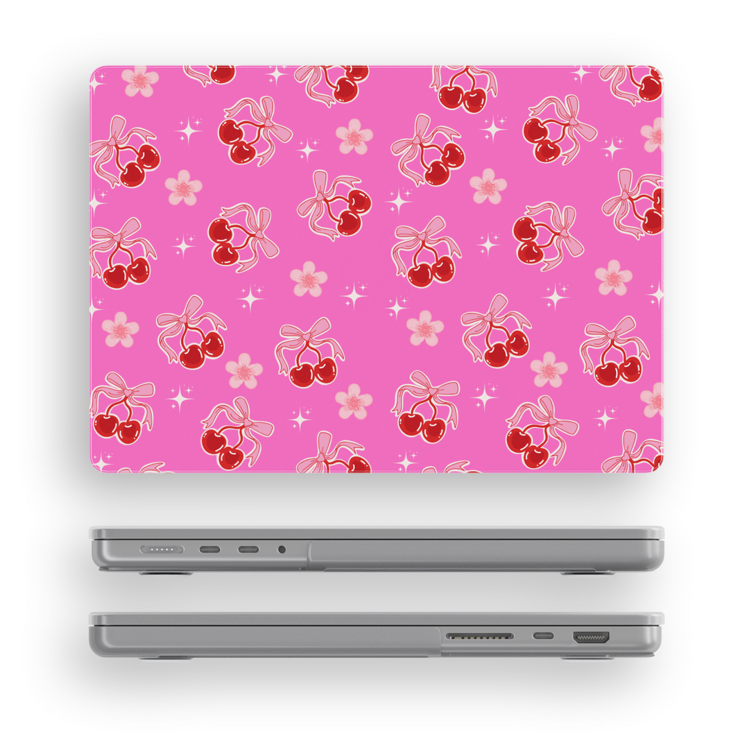 Girly MacBook case with pink background and cherry bow design – glossy laptop skin for MacBook Pro 13 14 16, Air 13 15, 2020 to 2024