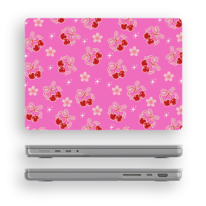 Girly MacBook case with pink background and cherry bow design – glossy laptop skin for MacBook Pro 13 14 16, Air 13 15, 2020 to 2024