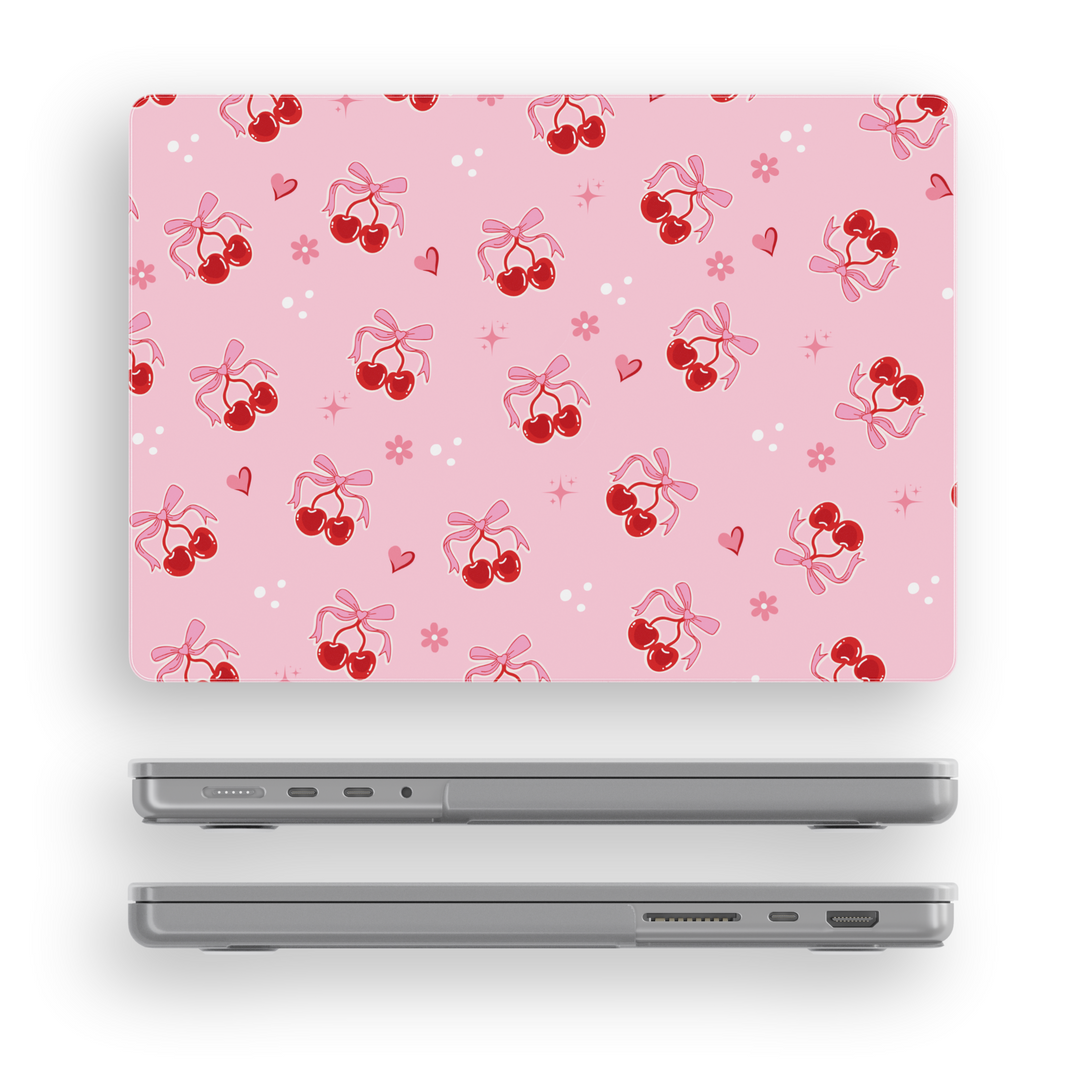 Pink MacBook case with cute cherry and bow pattern, perfect kawaii aesthetic laptop cover for students and girly MacBook Pro or Air users.
