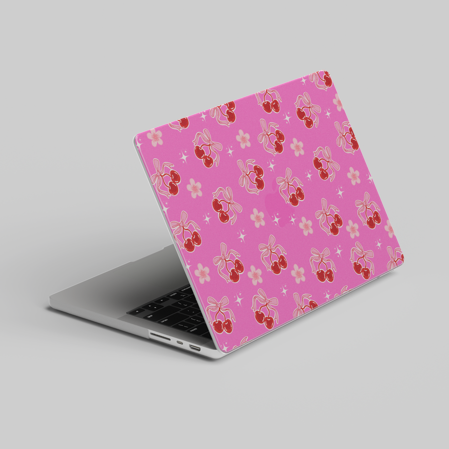 Girly MacBook case with pink background and cherry bow design – glossy laptop skin for MacBook Pro 13 14 16, Air 13 15, 2020 to 2024








